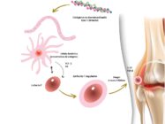 Tendencias En Salud Articular